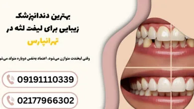 دلایل ایجاد لبخند لثه‌ای | شناخت علمی لبخندی که تعادل چهره را به‌هم می‌زند