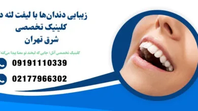 لبخندتان را جراحی کنید یا با لیزر اصلاح کنید؟ پاسخ این سؤال زندگیتان را تغییر میدهد