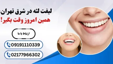 راز لبخند زیبا با لیفت لثه در شرق تهران | راهنمای کامل + نکات طلایی