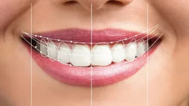 راز لبخندهای هالیوودی چیست؟ متخصصان زیبایی دندان پاسخ میدهند