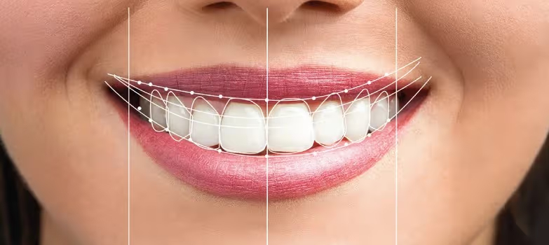 hollywood-smile.jpg