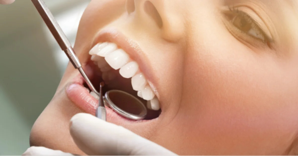 hollywood-smile-vs-veneers_20240604130751.jpg