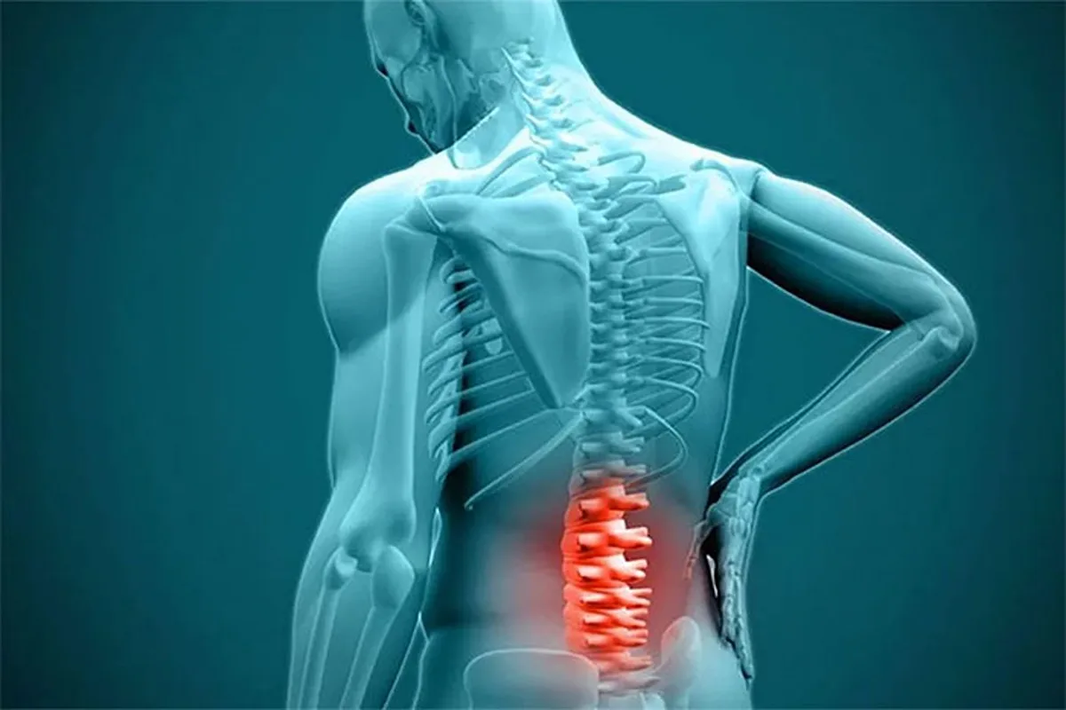 علائم دیسک کمر؛ نشانه‌هایی که نباید نادیده گرفته شوند