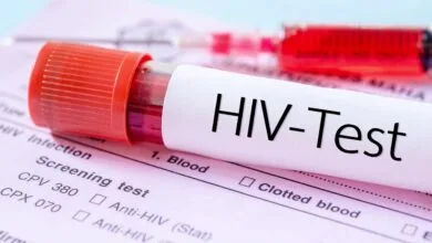 مهمترین چالش امروز HIV در ایران