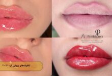 تکنیک های زیبایی لب با متد 2026