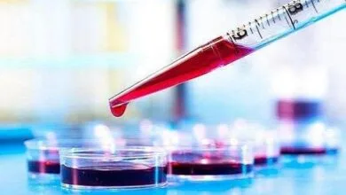 آزمایش خون می‌تواند بیماری کرون را پیش‌بینی کند