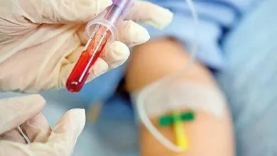 بیماری هموفیلی؛ از ابتلا تا پیشگیری