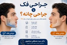 جراحی فک یا جراحی چانه با دکتر مرتضوی