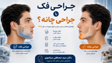 جراحی فک یا جراحی چانه با دکتر مرتضوی