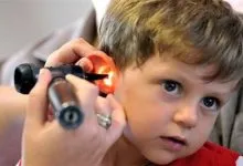 سکته گوش را جدی بگیرد؛ هشدار نسبت به کم شنوایی ناگهانی