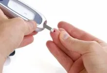 اِندومتریوز با خطر بالاتر دیابت نوع ۲ مرتبط است