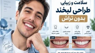 بازسازی لبخند پس از ازدست‌دادن دندان؛ از ایمپلنت تا طراحی لبخند