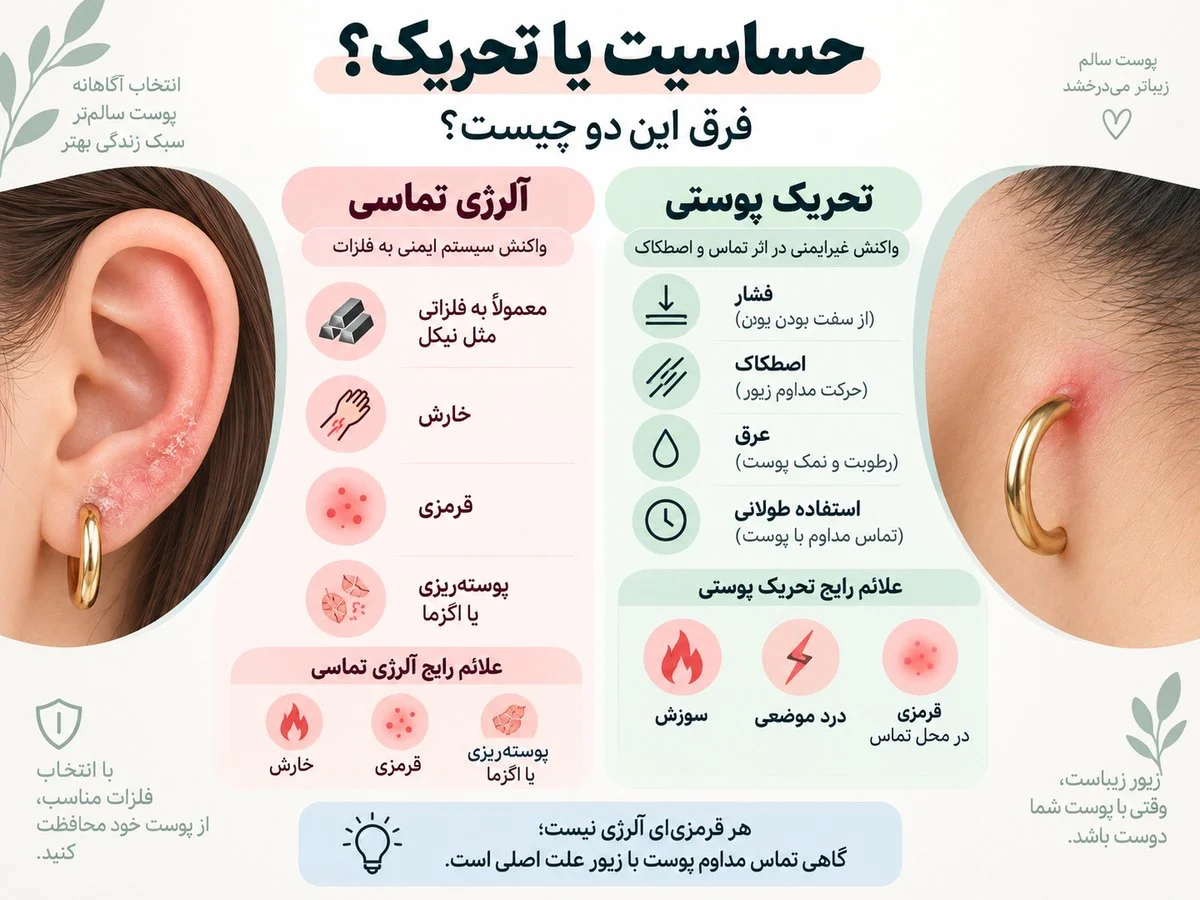 اینفوگرافیک تفاوت حساسیت تماسی و تحریک پوستی ناشی از زیورآلات